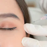 Estetik Dolgu Sonrası Dikkat Edilmesi Gerekenler